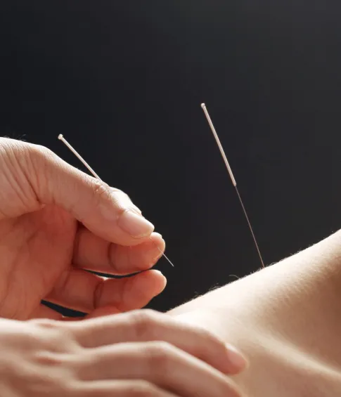 Пациент проходит процедуру иглоукалывания